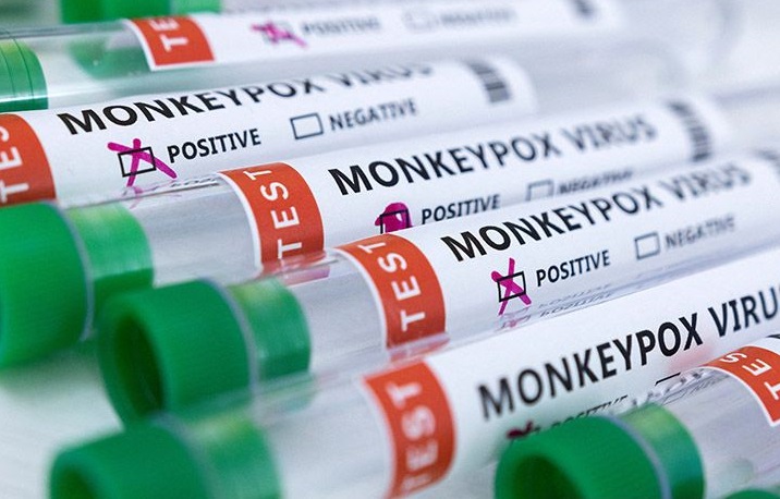 Kemenkes Perketat Pemeriksaan WNA untuk Cegah Penyebaran Virus Cacar&nbsp;Monyet